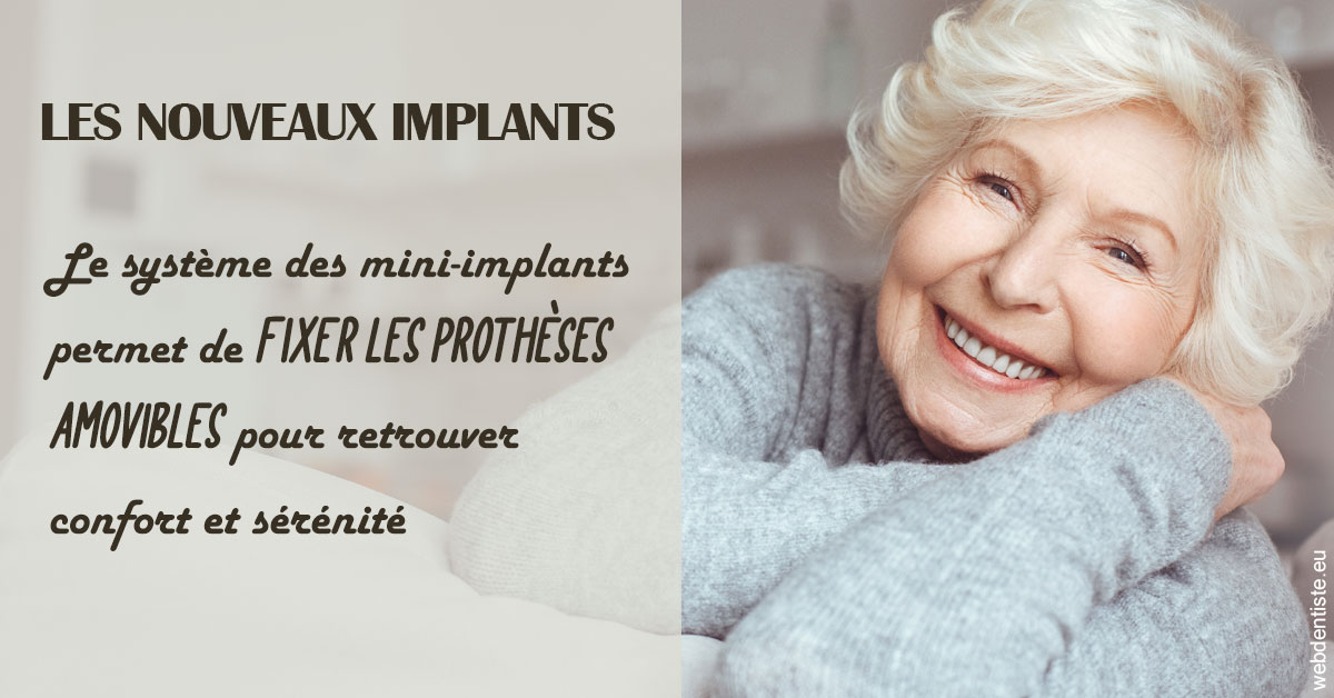 https://dr-boyer-sophie.chirurgiens-dentistes.fr/Les nouveaux implants 1