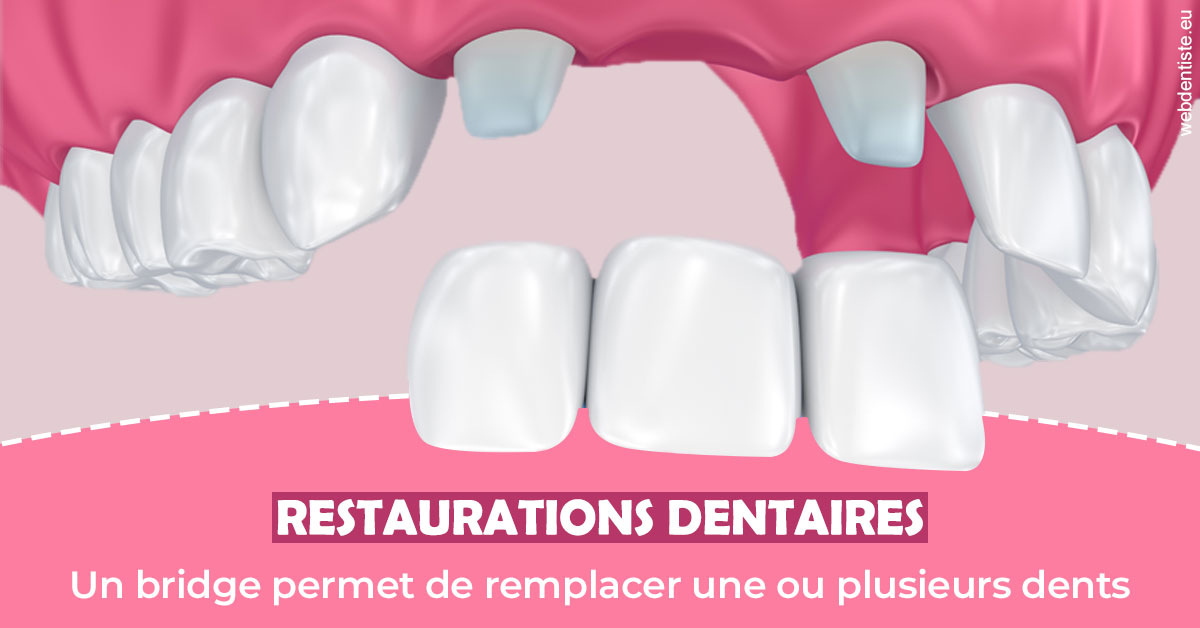 https://dr-boyer-sophie.chirurgiens-dentistes.fr/Bridge remplacer dents 2
