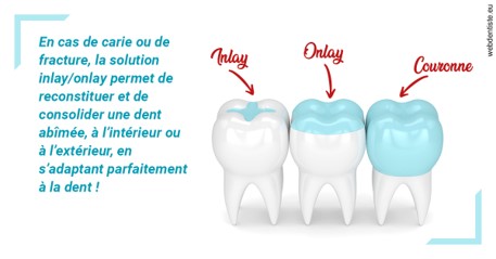 https://dr-boyer-sophie.chirurgiens-dentistes.fr/L'INLAY ou l'ONLAY