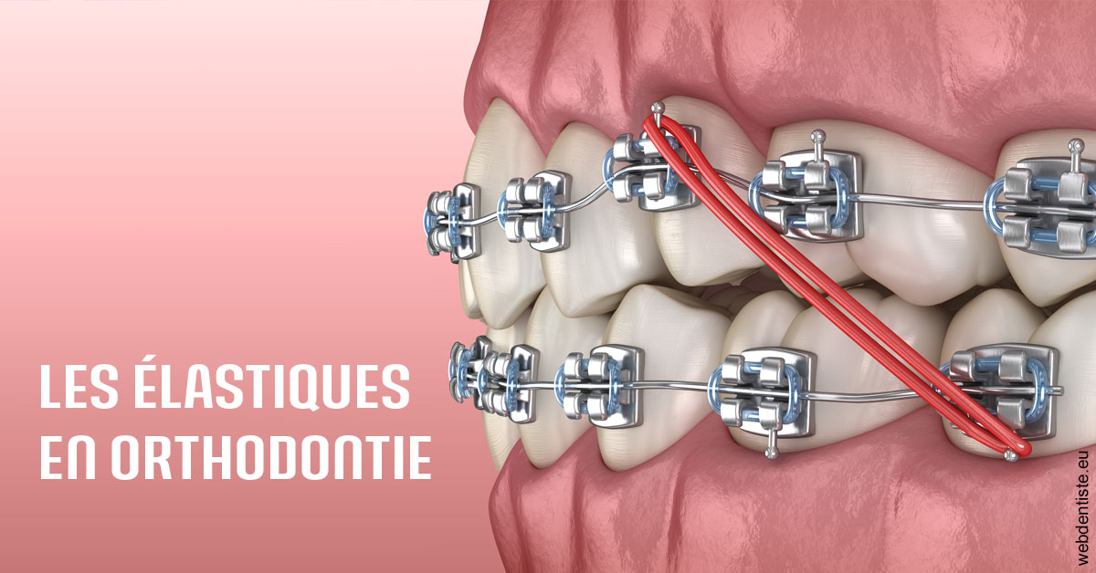 https://dr-boyer-sophie.chirurgiens-dentistes.fr/Elastiques orthodontie 2