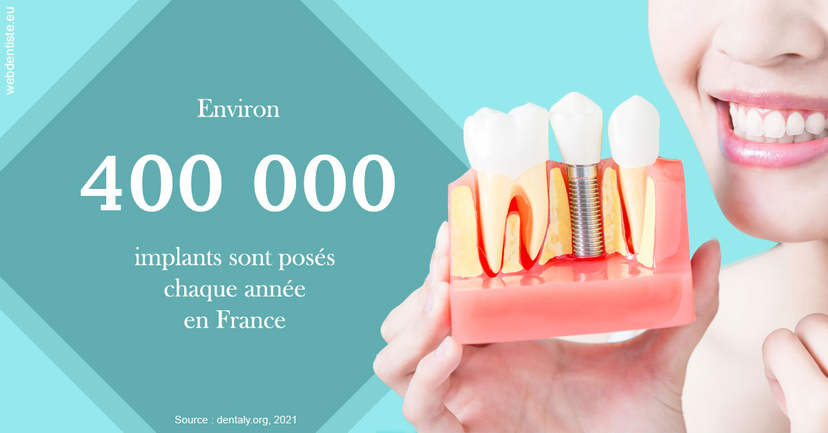 https://dr-boyer-sophie.chirurgiens-dentistes.fr/Pose d'implants en France 2